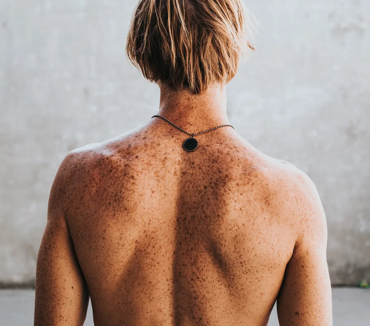 Rücken eines Mannes, der ein Hautscreening in München machen möchte und deshalb zur Krebs-Beratung beim Arzt ist