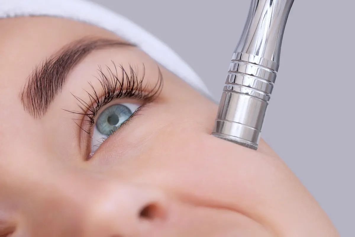 Microdermabrasion als apparative Methode der Hautverjüngung