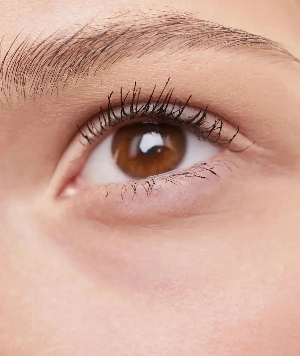 Ein Unterlid nachdem mit einer transkonjunktivale Blepharoplastik in München die Tränensäcke entfernt wurden