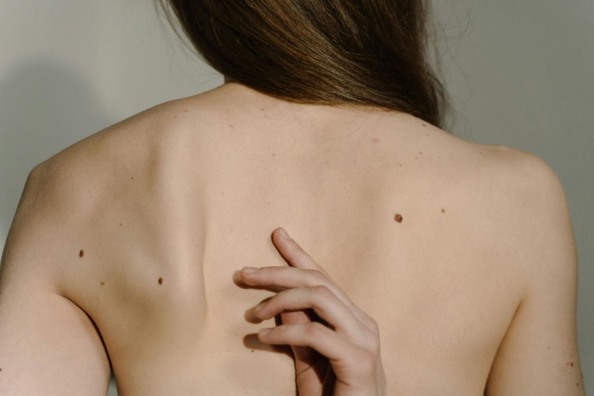 LC-OCT–Hautbiopsie